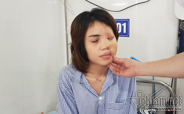 Bác sĩ kể lại hành trình hồi sinh gương mặt xinh đẹp cho cô gái bị thiếu úy tạt axit - Ảnh 4. Bác sĩ kể lại hành trình hồi sinh gương mặt xinh đẹp cho cô gái bị thiếu úy tạt axit - Ảnh 4.