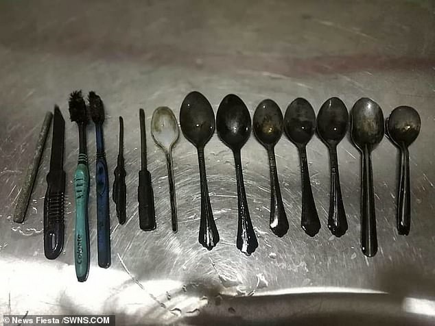 Phát hiện 1 con dao, 8 cái thìa và cả tua vít, bàn chải đánh răng trong dạ dày một người đàn ông Ấn Độ  - Ảnh 2.