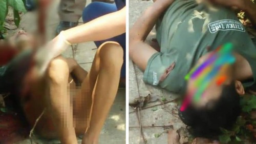 Vụ người đàn ông say rượu dùng dao tự đâm vào bụng: Nạn nhân phải cắt 1,8m ruột - Ảnh 1. Vụ người đàn ông say rượu dùng dao tự đâm vào bụng: Nạn nhân phải cắt 1,8m ruột - Ảnh 1.