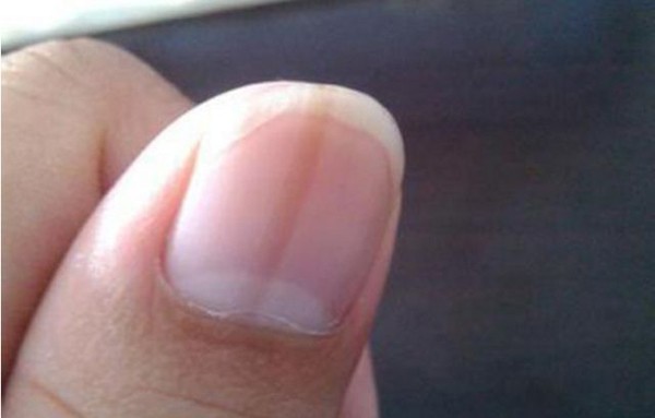 3 bộ phận này trên cơ thể ngày càng đen, báo hiệu gan đang suy yếu - Ảnh 2. 3 bộ phận này trên cơ thể ngày càng đen, báo hiệu gan đang suy yếu - Ảnh 2.