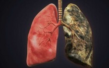 Phổi phải hít bụi, khói xe, thuốc lá mỗi ngày: Đây là cách dọn dẹp làm sạch những thứ 'bẩn thỉu' trong phổi bạn