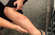 Cô giáo tát học sinh lớp 2 tím thái dương trong giờ kiểm tra học kỳ