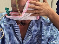 Điểm danh 8 'siêu hóa chất' trong thuốc lá đốt thanh quản của bạn
