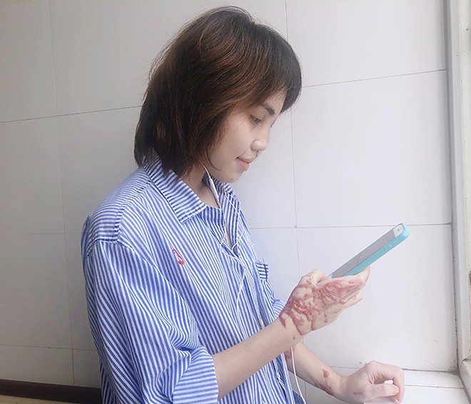 Cô gái 24 tuổi vượt qua cú sốc bị hôn phu tạt axit - Ảnh 2.
