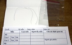 Ba lần thất vọng của anh Tây ở phòng xét nghiệm ADN Hà Nội