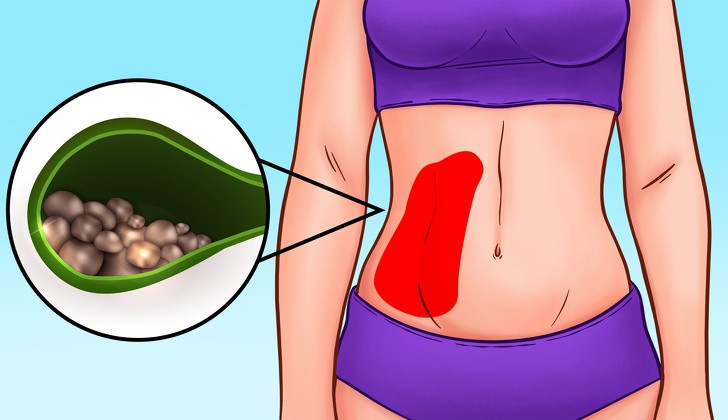 Các cơn đau nhói vùng bụng tố cáo sức khỏe bạn đang có vấn đề - Ảnh 7. Các cơn đau nhói vùng bụng tố cáo sức khỏe bạn đang có vấn đề - Ảnh 7.