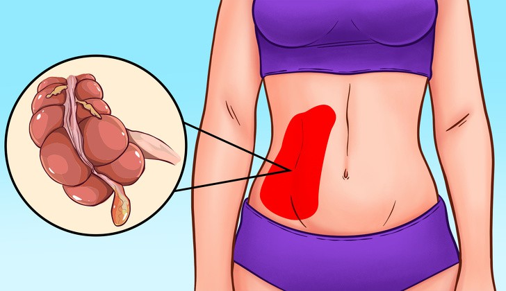 Các cơn đau nhói vùng bụng tố cáo sức khỏe bạn đang có vấn đề - Ảnh 8. Các cơn đau nhói vùng bụng tố cáo sức khỏe bạn đang có vấn đề - Ảnh 8.