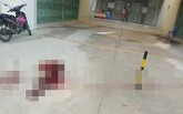Điều tra vụ bảo vệ chung cư bị chém đứt lìa cánh tay