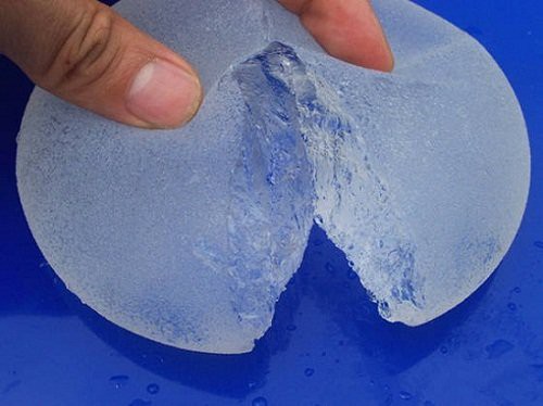 giá-nâng-ngực-chảy-xệ-1 giá-nâng-ngực-chảy-xệ-1