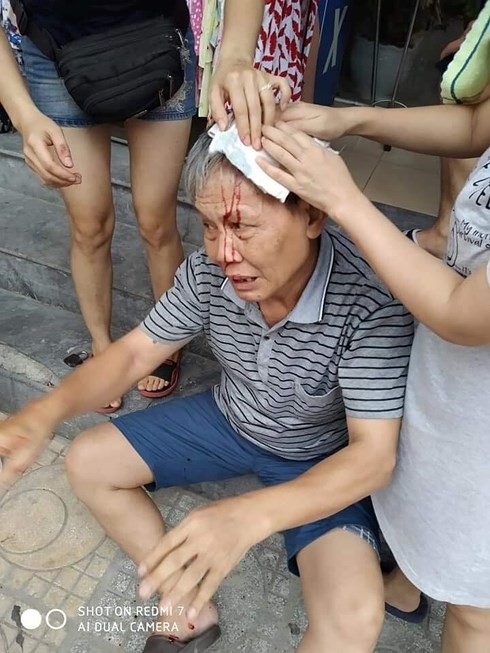 Văn hóa chung cư: Nghìn chuyện bi hài, cười ra... nước mắt - Ảnh 3. Văn hóa chung cư: Nghìn chuyện bi hài, cười ra... nước mắt - Ảnh 3.