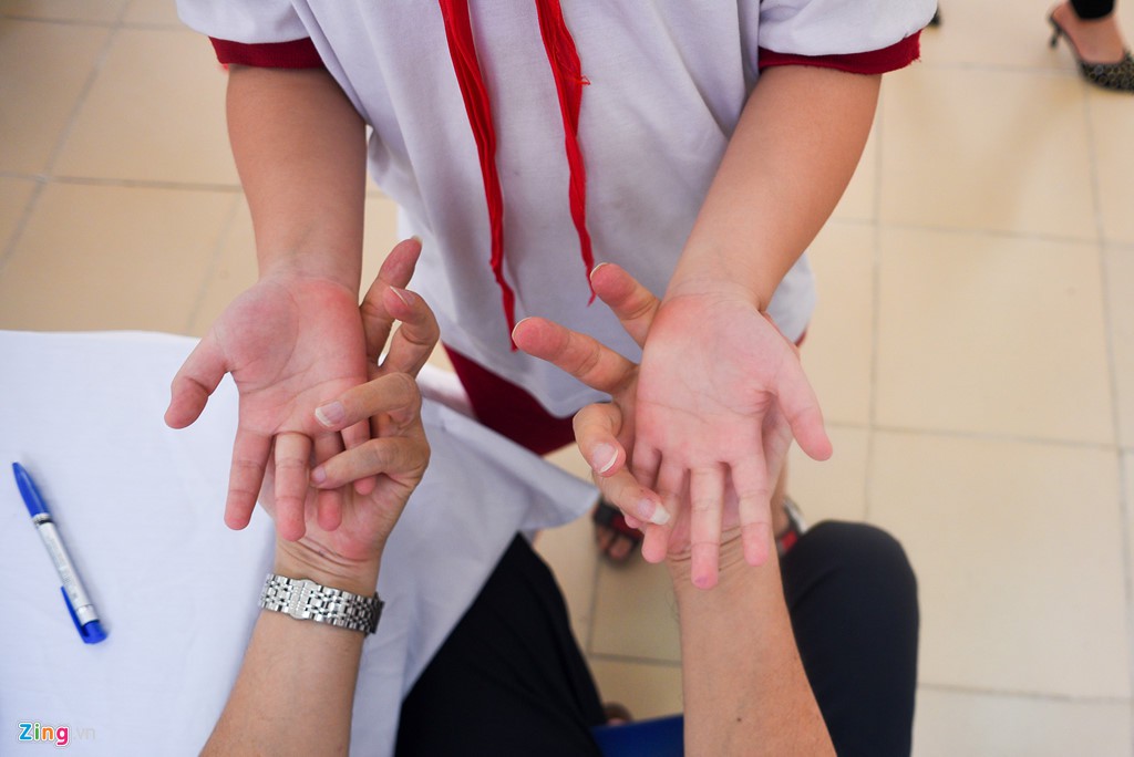 Khám miễn phí cho hàng trăm học sinh Hạ Đình sau vụ cháy Rạng Đông - Ảnh 4. Khám miễn phí cho hàng trăm học sinh Hạ Đình sau vụ cháy Rạng Đông - Ảnh 4.