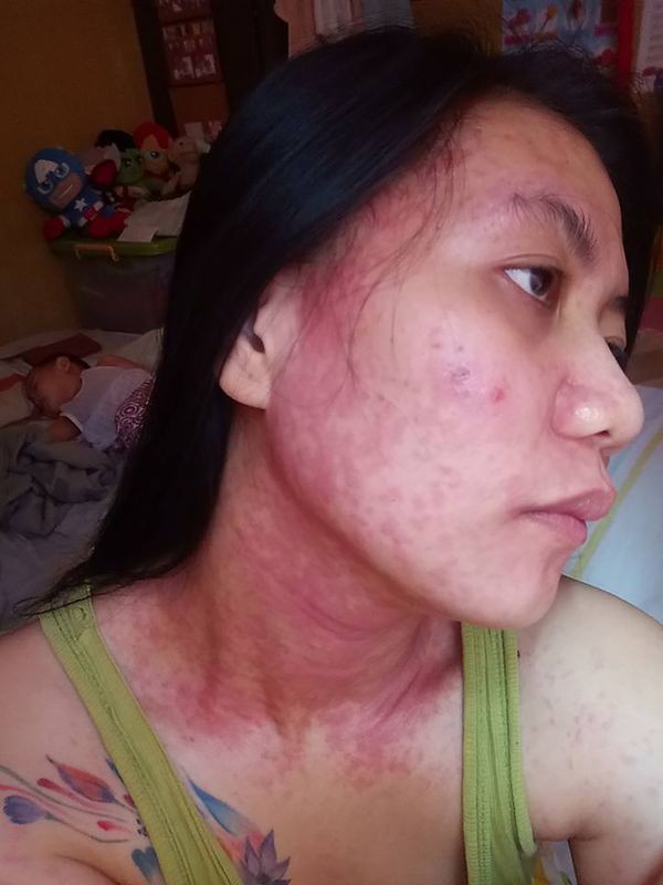 Không ai biết thế giới có bao nhiêu loại kem làm sáng da nhiễm độc thủy ngân - Ảnh 3.