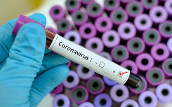 Lộ diện công ty Trung Quốc vừa sản xuất thành công thuốc điều trị virus corona