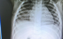 Tin vui của cháu bé cách li Covid-19 cùng mẹ