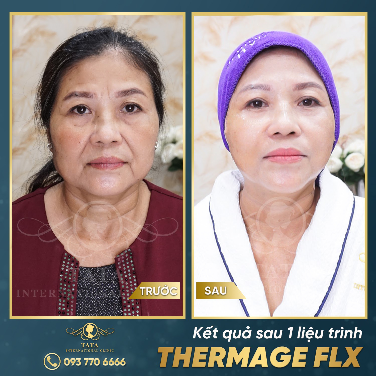 Hành trình 10 năm lấy lại tuổi thanh xuân của chị giá 'ngũ tuần' - Ảnh 4. Hành trình 10 năm lấy lại tuổi thanh xuân của chị giá 'ngũ tuần' - Ảnh 4.