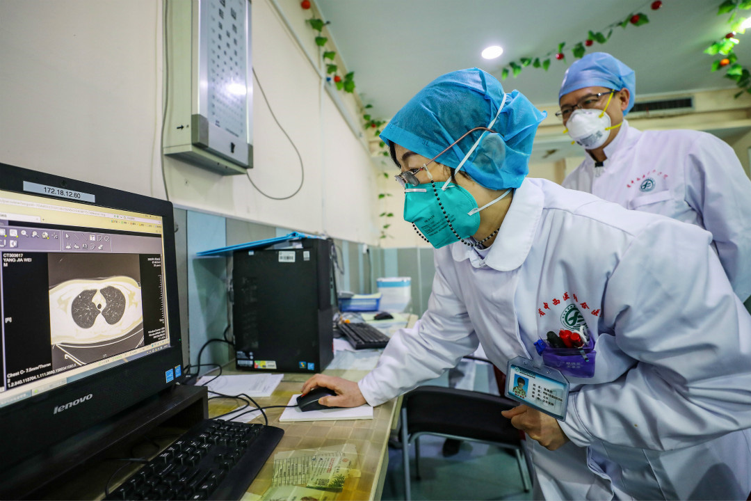 Virus Corona gây dịch Covid-19 có đột biến gien giống virus HIV - Ảnh 1. Virus Corona gây dịch Covid-19 có đột biến gien giống virus HIV - Ảnh 1.