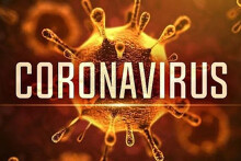 Nếu 1 công nhân nhiễm virus corona, chỉ 2 tuần doanh nghiệp mất hiệu quả cả năm 2020