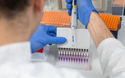Vì sao tiến trình tạo vaccine ì ạch dù virus corona lây lan chóng mặt?