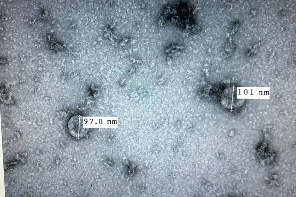 72 giờ nuôi cấy virus corona mới của Việt Nam - Ảnh 2.