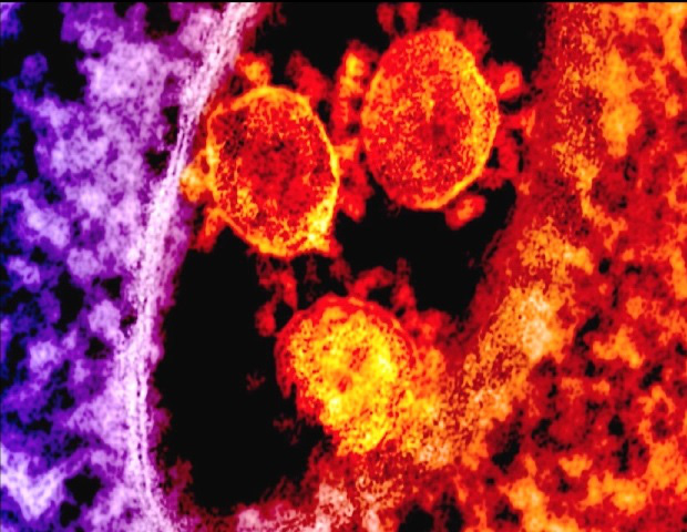 Virus corona sẽ sớm không còn “đất diễn” - Ảnh 2. Virus corona sẽ sớm không còn “đất diễn” - Ảnh 2.
