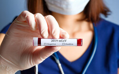 Mỹ gấp rút sản xuất bộ xét nghiệm máu về khả năng miễn dịch virus corona