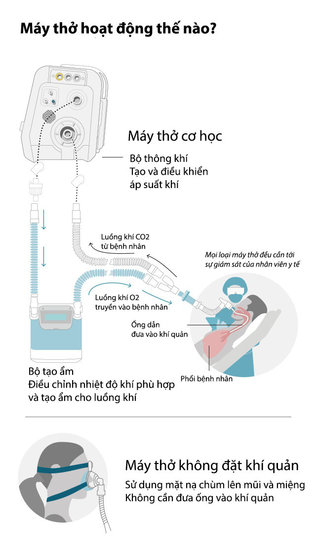 Máy thở là gì và vì sao nó rất quan trọng trong cuộc chiến Covid-19? - Ảnh 2. Máy thở là gì và vì sao nó rất quan trọng trong cuộc chiến Covid-19? - Ảnh 2.