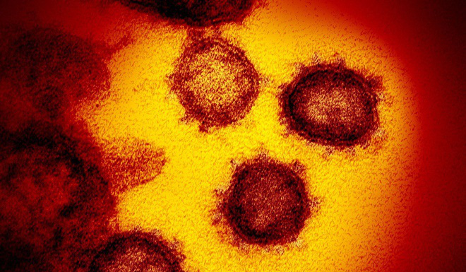 'Virus có thể đã lây trên người nhiều thập kỉ mới bùng phát ở Vũ Hán' - Ảnh 2.