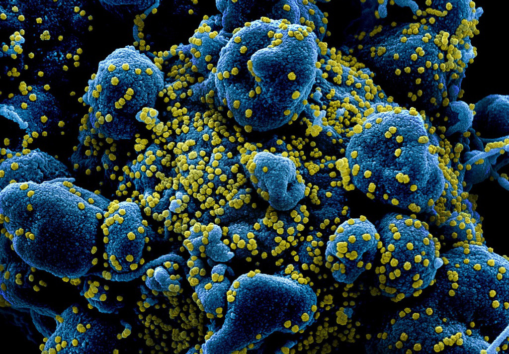Khía cạnh tích cực khi virus Corona 'tiến hóa' - Ảnh 4. Khía cạnh tích cực khi virus Corona 'tiến hóa' - Ảnh 4.