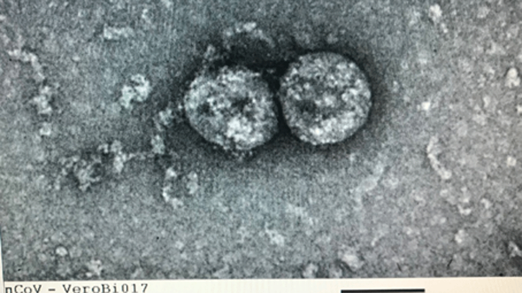 Virus gây dịch Covid-19 tại Việt Nam đã tiến hóa, có sự khác biệt rõ rệt - Ảnh 1.