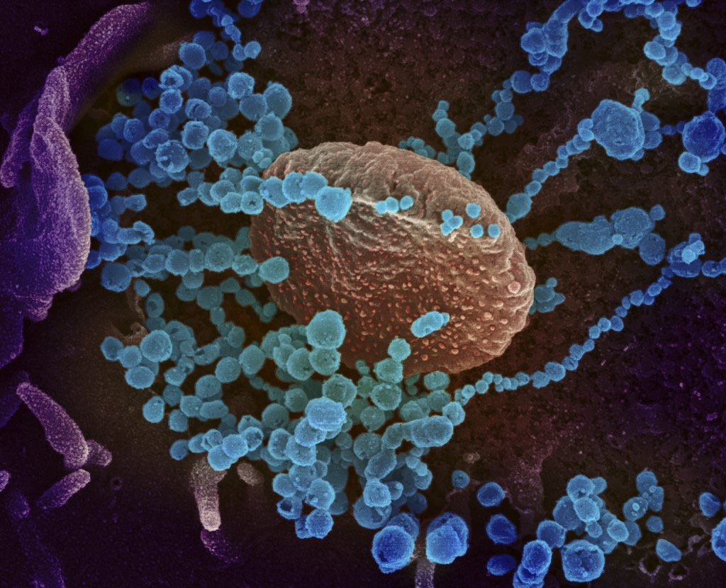 COVID-19: Thuốc trị chấy có thể là chìa khóa điều trị virus Covid-19 chỉ trong 48 giờ? - Ảnh 4. COVID-19: Thuốc trị chấy có thể là chìa khóa điều trị virus Covid-19 chỉ trong 48 giờ? - Ảnh 4.