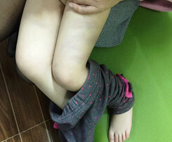 Thanh Hóa: Đình chỉ giáo viên đánh bé 2 tuổi bầm tím đùi