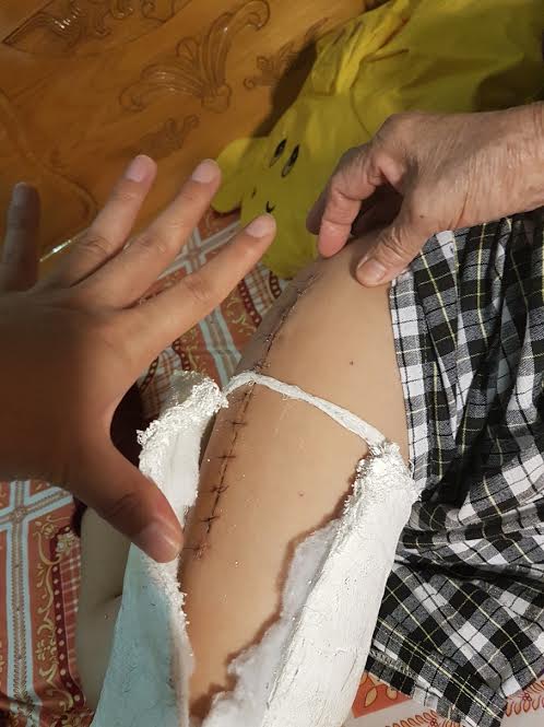 vu hoc sinh gay xuong dui phieu khao sat sai su that ai phai chiu trach nhiem
