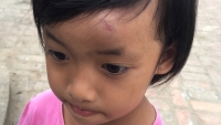 vu co giao nem dep trung dau tre gia dinh chap nhan giai quyet tinh cam