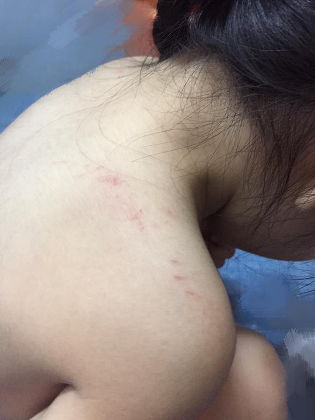 phu huynh buc xuc to co giao truong mn quoc te danh con gai 3 tuoi tray xuoc khap nguoi