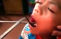 Kinh hoàng phát hiện con vắt sống trong họng bé gái 12 tuổi ở Nghệ An suốt 2 tháng