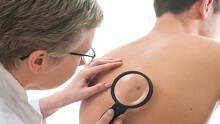 Tiếp xúc quá mức ánh sáng mặt trời dễ bị ung thư da