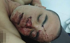 Làm rõ vụ công an bắn đạn cao su khi xô xát với dân