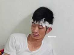 Vụ tài xế taxi Mai Linh bị đánh: Xử lý theo quy định pháp luật, không bao che