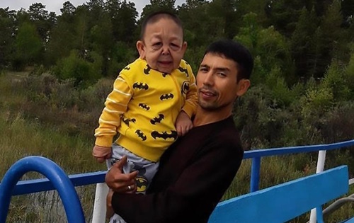 can benh hiem khien cau be 6 tuoi kazakhstan trong nhu ong lao