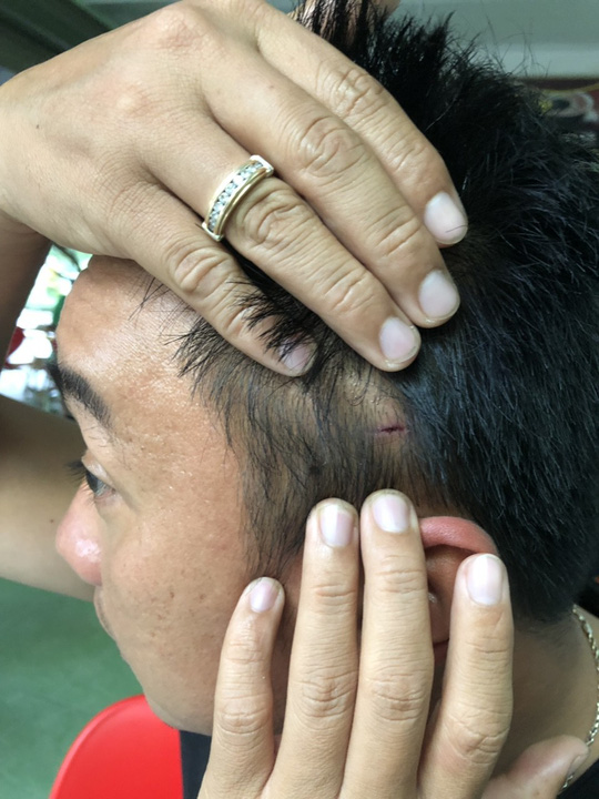 vu csgt danh nhau voi tai xe thong tin bat ngo ve nhom nguoi tren xe tai