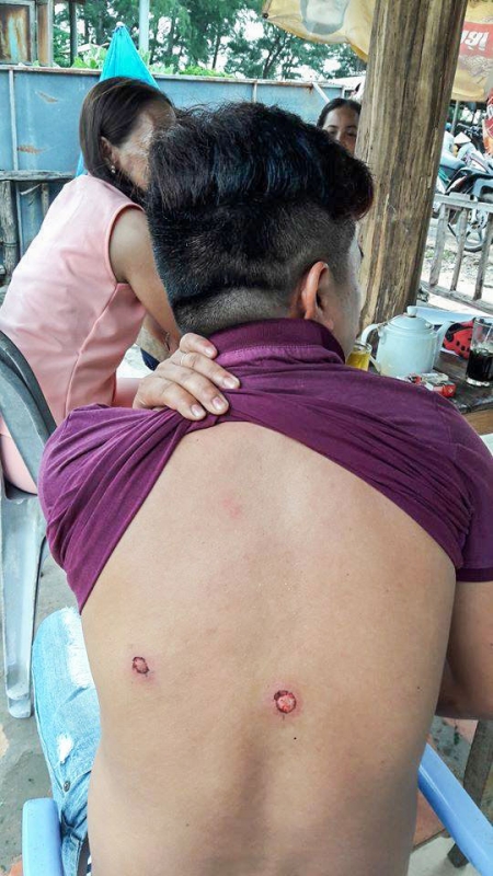 binh thuan mot thanh nien to bi cong an xa ban vao lung