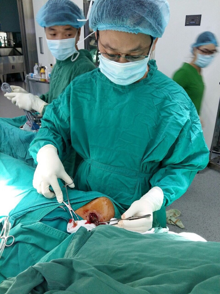 mo lay di vat nam trong nguoi nam thanh nien hon 2 thang