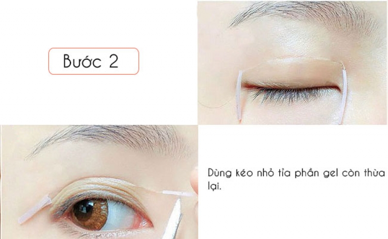 meo khac phuc mat khong deu hay nhu tan hoa hau do my linh