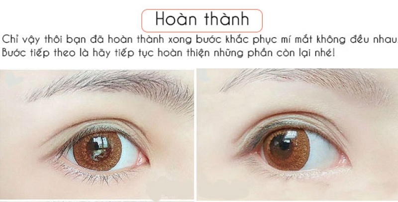 meo khac phuc mat khong deu hay nhu tan hoa hau do my linh
