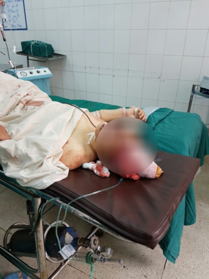 dak nong cuu song nguoi vo bi chong chem vo so