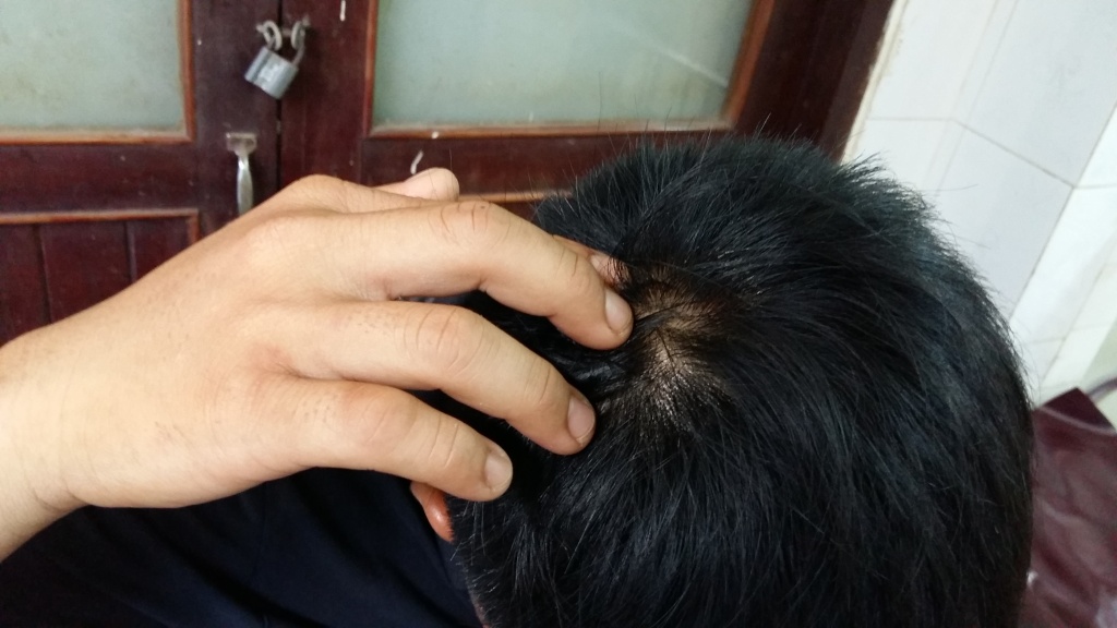 vi pham giao thong 3 thanh nien bi cong an xa dung sung cao su ban bi thuong