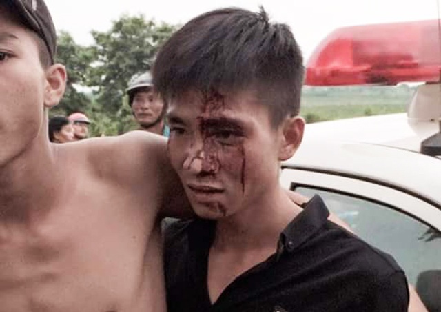 xac minh vu viec dan to cong an danh dan