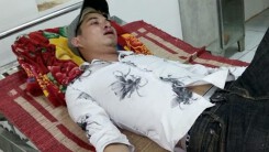 Lãnh đạo Công an tỉnh Đắk Nông chỉ đạo điều tra vụ nam thanh niên 'tố' bị CSGT 'đập gậy vào mặt'