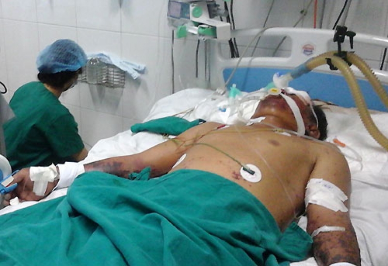 uong ruou vat chanh khi an tiet canh se diet duoc khuan lien cau lon