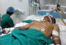 can tet bo y te khuyen khong an tiet canh de tranh nhung can benh rung minh